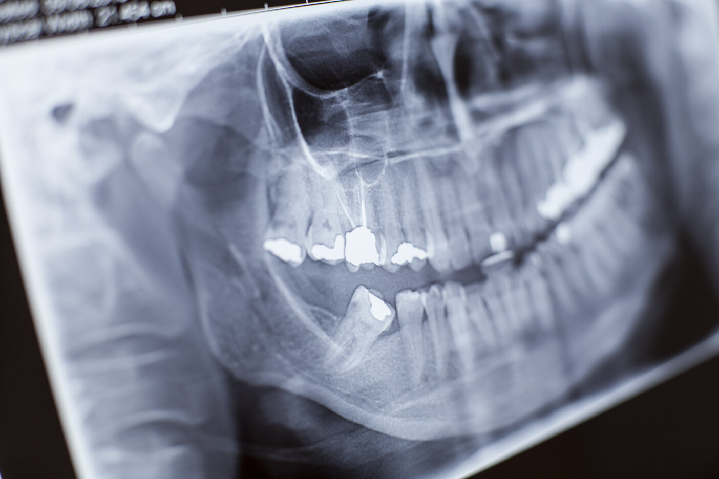 Dental Trauma Peterborough
