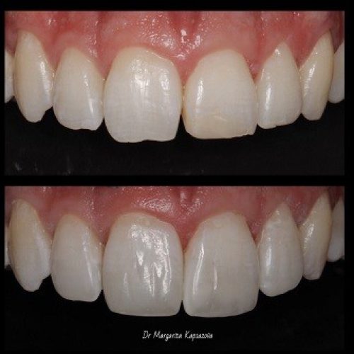 Cosmetic Dentistry Before And After Pictures 11.jpg